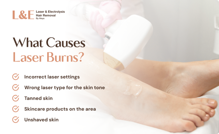 5 Reasons You Get Laser Burns & How To Prevent Them