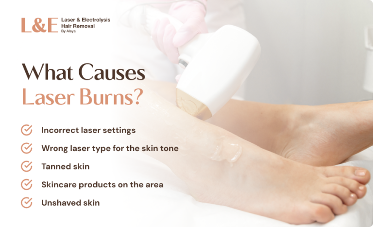 5 Reasons You Get Laser Burns & How To Prevent Them