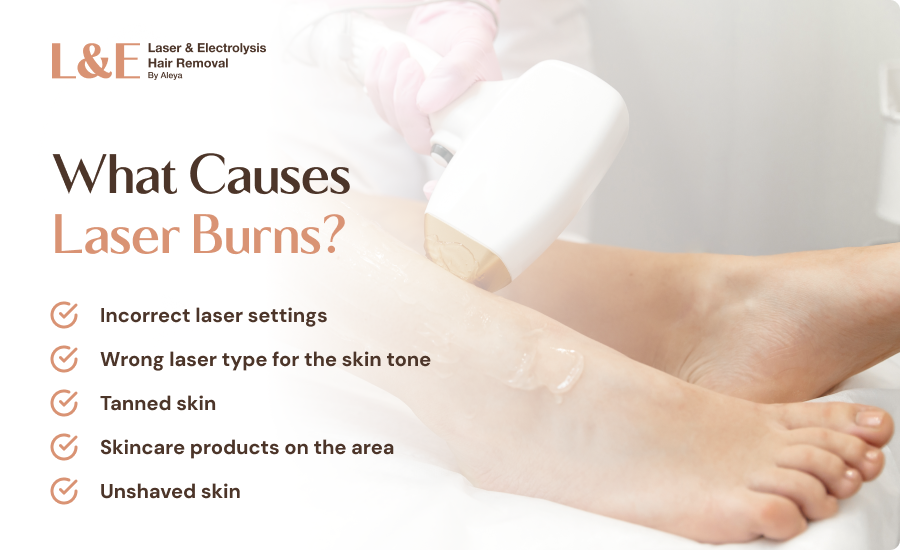 5 Reasons You Get Laser Burns & How To Prevent Them