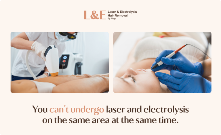 Can Laser and Electrolysis Hair Removal Be Done at the Same Time?