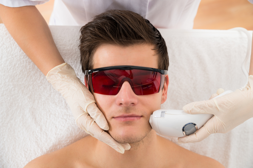 Man-facial-laser-hair-removal