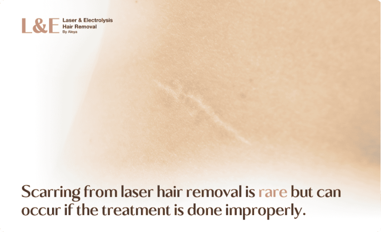 Laser Hair Removal Scars Explained [+ Ingrown Hair Scars FAQs]