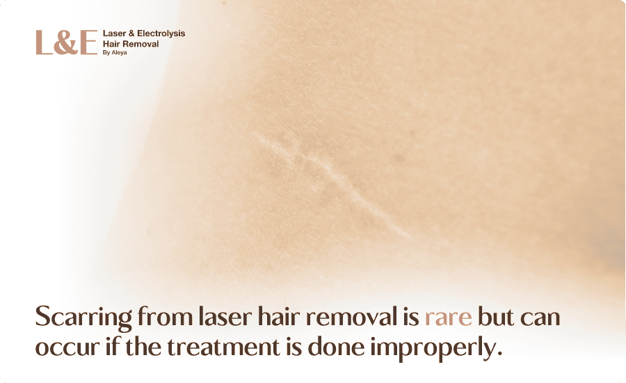 Laser Hair Removal Scars Explained [+ Ingrown Hair Scars FAQs]