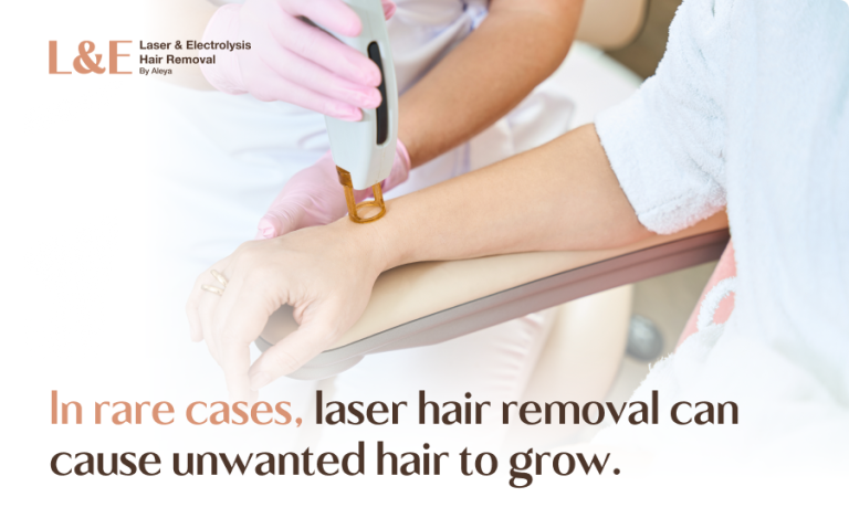 Can Laser Hair Removal Cause Unwanted Hair To Grow? [+ FAQs]