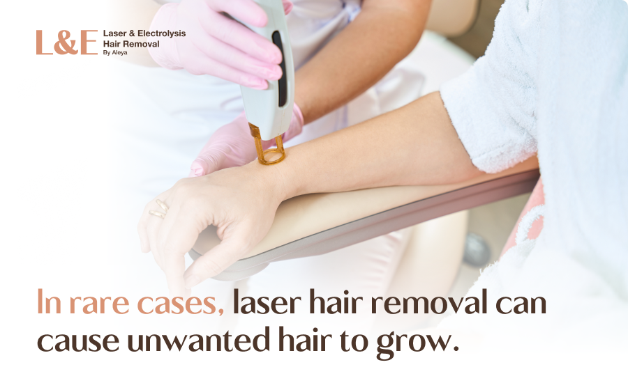 Can Laser Hair Removal Cause Unwanted Hair To Grow? [+ FAQs]