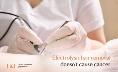 Electrolysis Hair Removal Side Effects: What You Need to Know