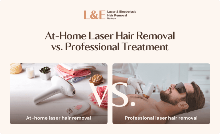At-Home Laser Hair Removal vs. Professional Treatment