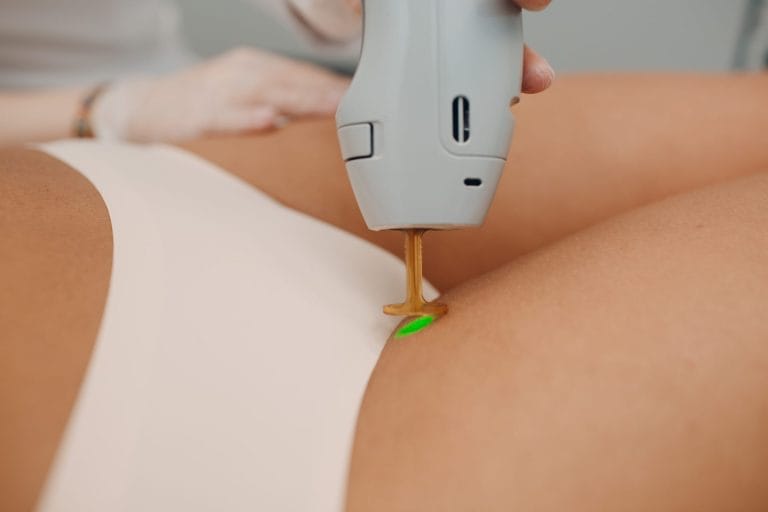 Bikini laser hair removal
