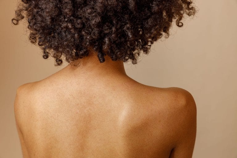 electrolysis-back-hair-removal