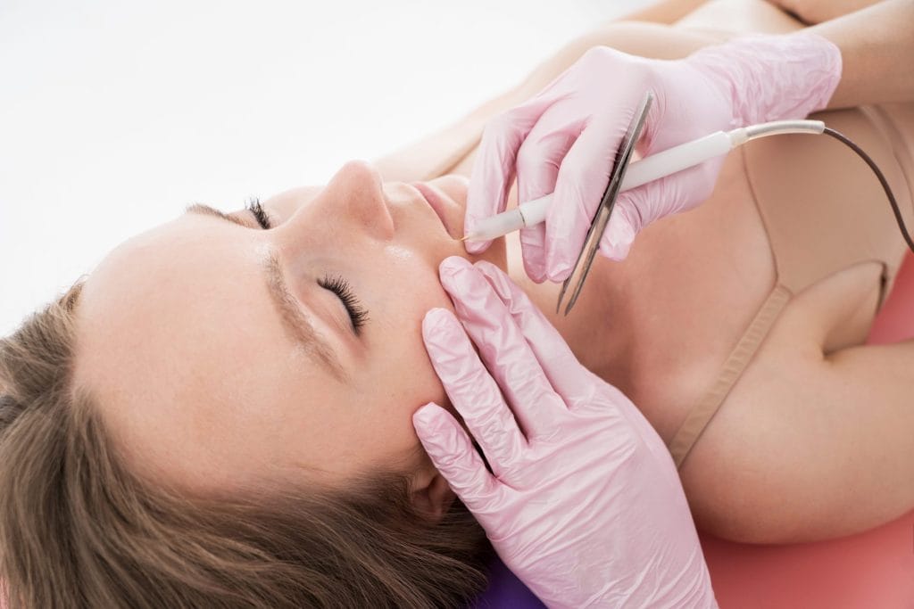 how-electrolysis-hair-removal-works-insertion