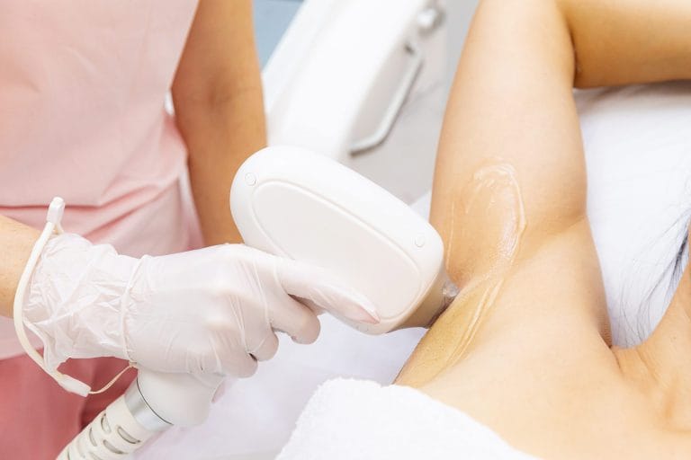underarm-laser-hair-removal