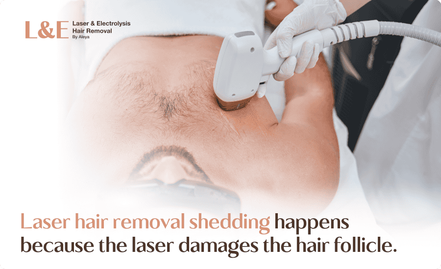Laser Hair Removal Shedding: What To Expect & FAQs