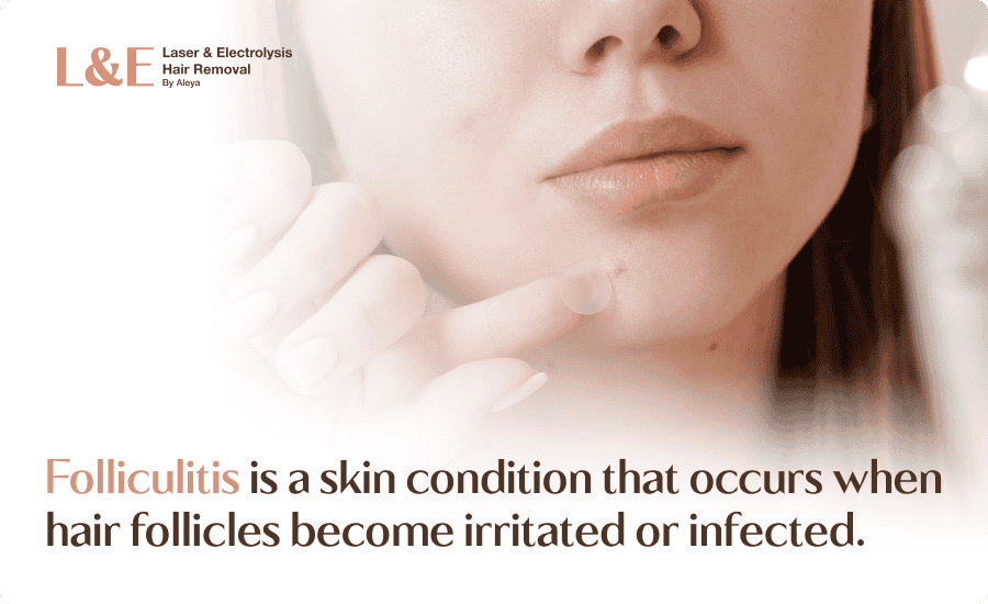 Laser Hair Removal Folliculitis: Prevention, Treatment & FAQs