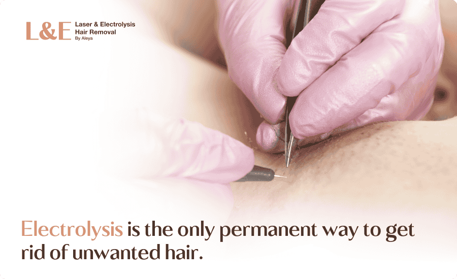 Permanent Hair Removal Guide: Comparing Your Options