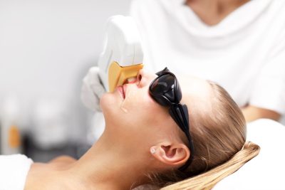 Face laser hair removal