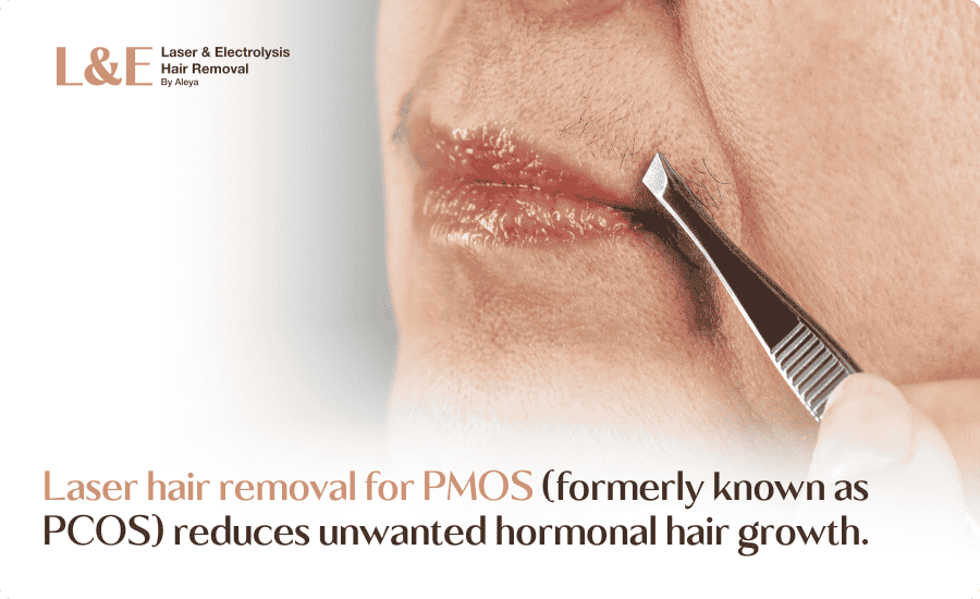 Laser Hair Removal for PMOS: Does It Really Work? [+ FAQs]