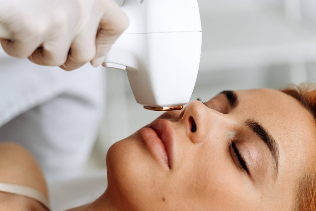 Upper Lip Laser Hair Removal - Laser by Aleya
