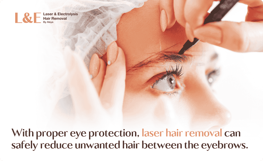 Laser Hair Removal for the Eyebrows: Is It Worth It?