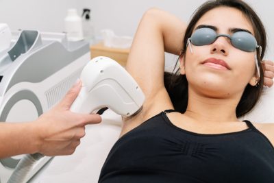Underarm laser hair removal step 3