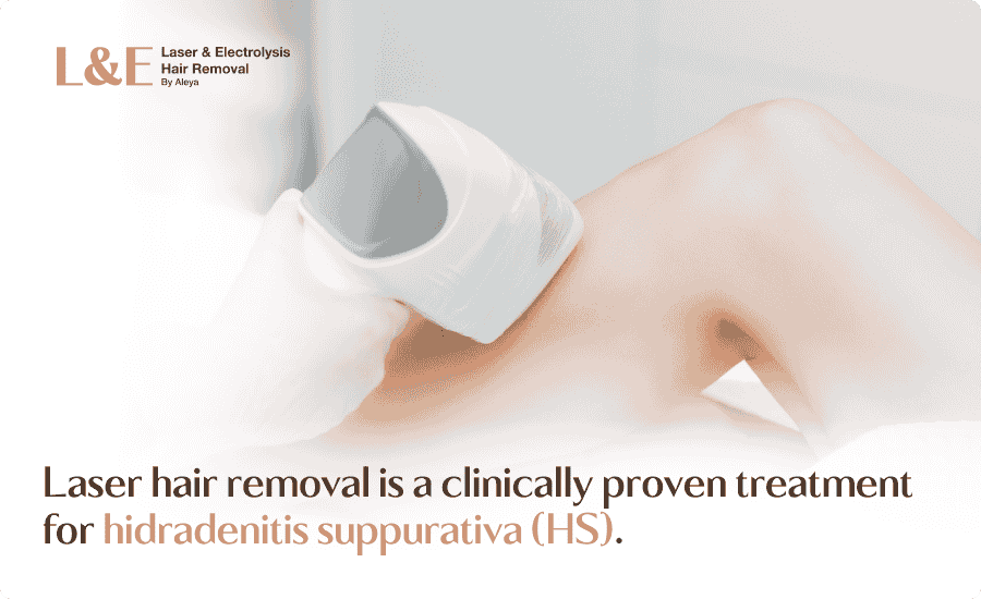 Laser Hair Removal for Hidradenitis Suppurativa: HS Relief