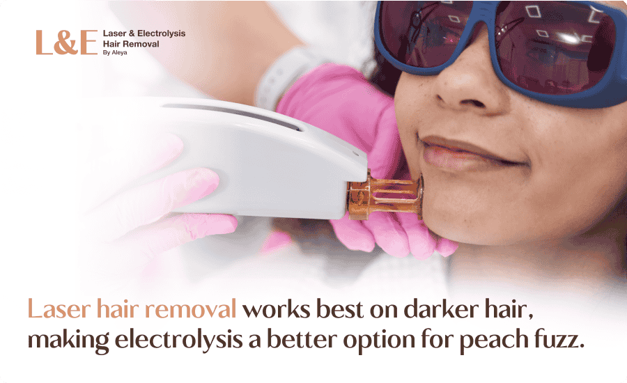 Vellus Hair and Peach Fuzz: Can You Laser It Off?