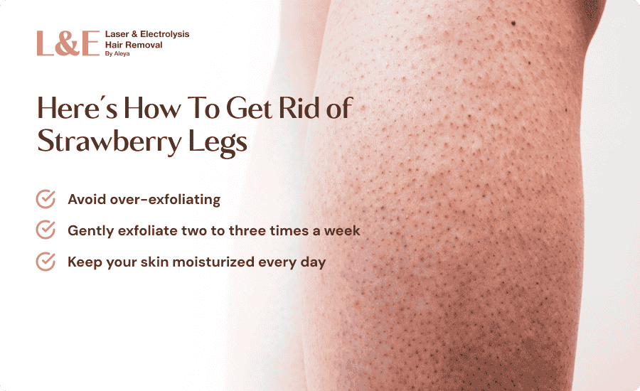 An infographic highlighting how to remove strawberry legs