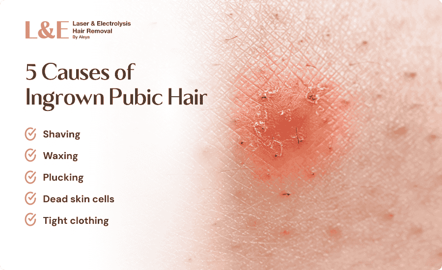 Ingrown Pubic Hair: Causes, Treatment & Prevention