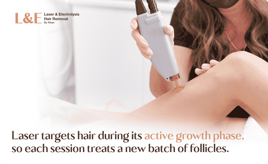 An infographic highlighting how laser hair removal results change throughout the sessions