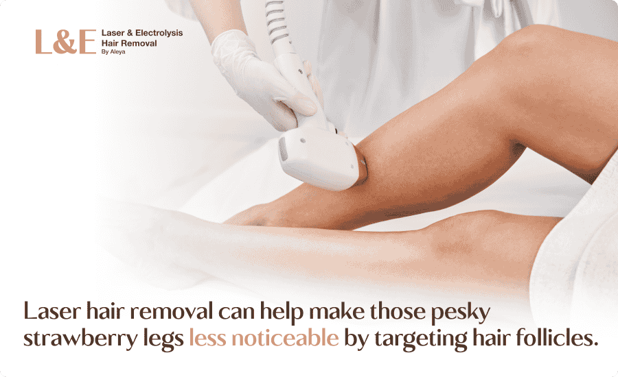 An infographic highlighting how laser hair removal can remove strawberry legs