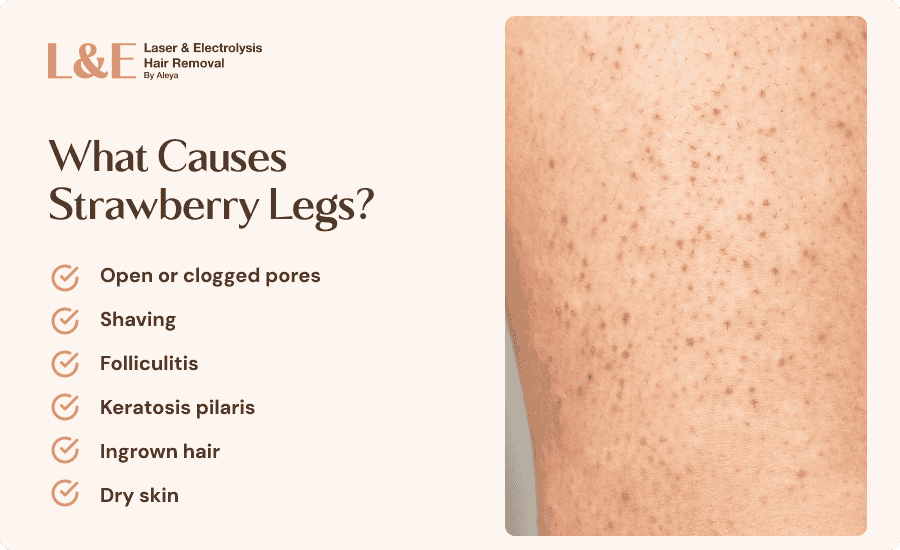 Strawberry Legs: Why They Happen and How To Treat Them